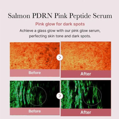 Medicube PDRN Pink Peptide Serum 30ml