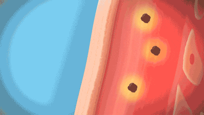 Animazione illustrativa dei microconi ACROPASS a contatto con la pelle