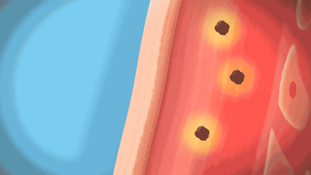 Animazione illustrativa dei microconi ACROPASS a contatto con la pelle