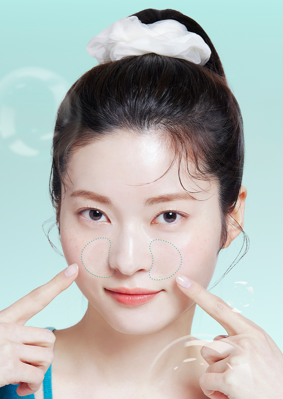 ACROPASS Pore Care: esempio di applicazione dei patch sulle guance