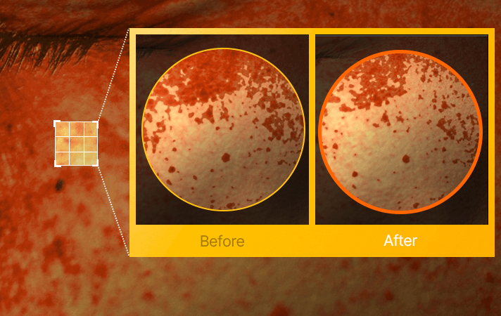 CELLOLOGY MELITURN SHOT GUN – dettaglio 7