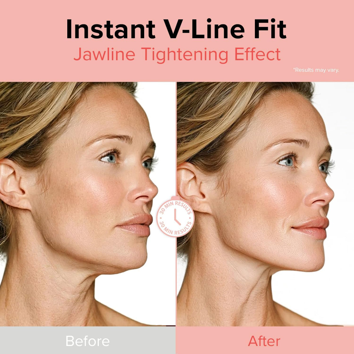 idPLACOSMETICS Face Fit Minus Band V2 – dettaglio 2