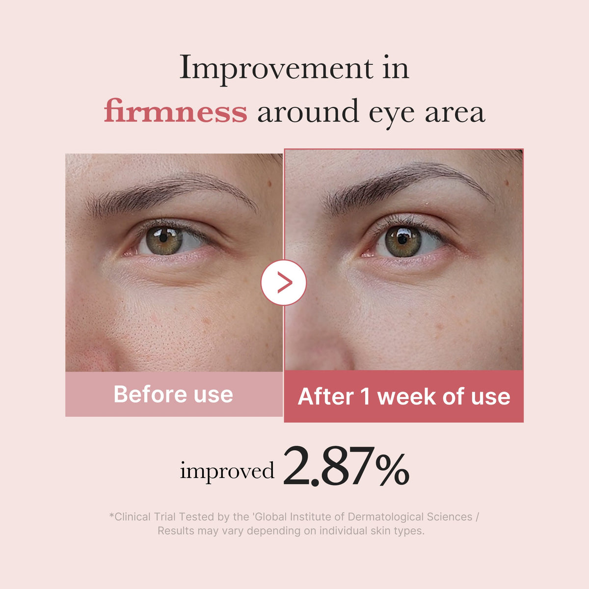 Medicube PDRN Pink Peptide Eye Cream – 30 ml – dettaglio 3