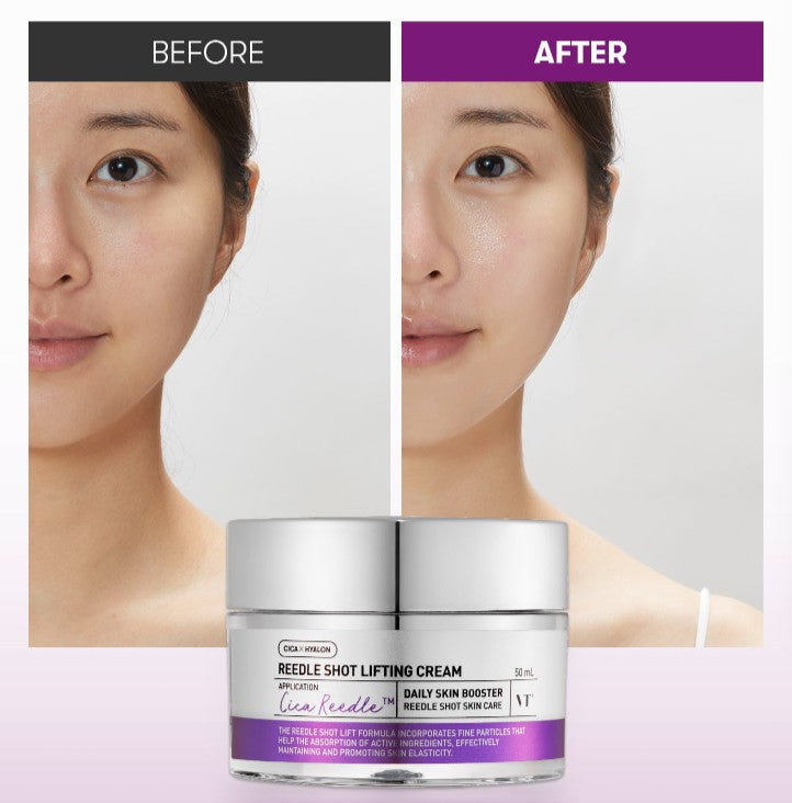 VT REEDLE SHOT LIFTING CREAM — dettaglio 1
